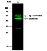 SERPINB3 Antibody in Immunoprecipitation (IP)