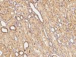 SIPA1 Antibody in Immunohistochemistry (Paraffin) (IHC (P))