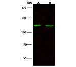 SIPA1 Antibody in Western Blot (WB)