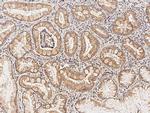 SLC27A5 Antibody in Immunohistochemistry (Paraffin) (IHC (P))