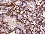 CD98 Antibody in Immunohistochemistry (Paraffin) (IHC (P))