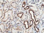 SOD2 Antibody in Immunohistochemistry (Paraffin) (IHC (P))