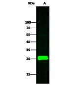 SOD2 Antibody in Western Blot (WB)