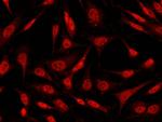 STAT4 Antibody in Immunocytochemistry (ICC/IF)