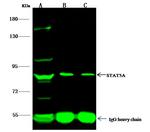 STAT5 alpha Antibody in Immunoprecipitation (IP)