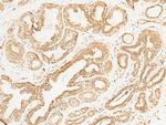 STIM1 Antibody in Immunohistochemistry (Paraffin) (IHC (P))