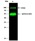 STIM1 Antibody in Immunoprecipitation (IP)