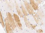 TET1 Antibody in Immunohistochemistry (Paraffin) (IHC (P))