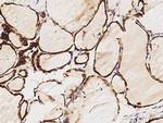 Thyroid Peroxidase Antibody in Immunohistochemistry (Paraffin) (IHC (P))