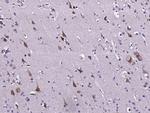 TNFR1 Antibody in Immunohistochemistry (Paraffin) (IHC (P))