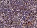 CD30 Antibody in Immunohistochemistry (Paraffin) (IHC (P))