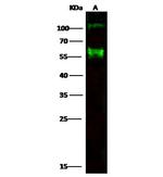 CD30 Antibody in Western Blot (WB)