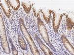 TRAIL Antibody in Immunohistochemistry (Paraffin) (IHC (P))