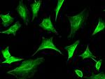 TRAF6 Antibody in Immunocytochemistry (ICC/IF)