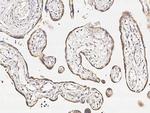 TREM1 Antibody in Immunohistochemistry (Paraffin) (IHC (P))