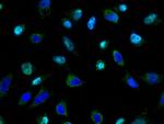 TSG101 Antibody in Immunocytochemistry (ICC/IF)