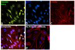 TSG101 Antibody in Immunocytochemistry (ICC/IF)