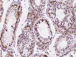 UNG Antibody in Immunohistochemistry (Paraffin) (IHC (P))