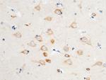 VAPB Antibody in Immunohistochemistry (Paraffin) (IHC (P))