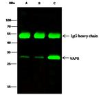 VAPB Antibody in Immunoprecipitation (IP)