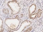 WDR77 Antibody in Immunohistochemistry (Paraffin) (IHC (P))