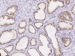 ZIC3 Antibody in Immunohistochemistry (Paraffin) (IHC (P))