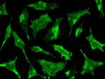 STX8 Antibody in Immunocytochemistry (ICC/IF)