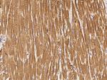 STX8 Antibody in Immunohistochemistry (Paraffin) (IHC (P))