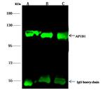 beta-1 Adaptin Antibody in Immunoprecipitation (IP)