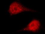 ASF1A Antibody in Immunocytochemistry (ICC/IF)