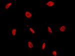 HP1 beta Antibody in Immunocytochemistry (ICC/IF)