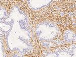 Calponin 1 Antibody in Immunohistochemistry (Paraffin) (IHC (P))