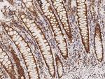 VDR Antibody in Immunohistochemistry (Paraffin) (IHC (P))