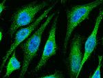 ETS1 Antibody in Immunocytochemistry (ICC/IF)