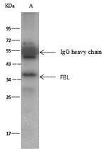 Fibrillarin Antibody in Immunoprecipitation (IP)