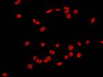 c-Fos Antibody in Immunocytochemistry (ICC/IF)