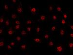 Fra1 Antibody in Immunocytochemistry (ICC/IF)