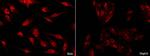 GLI1 Antibody in Immunocytochemistry (ICC/IF)