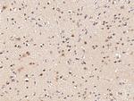 GLI1 Antibody in Immunohistochemistry (Paraffin) (IHC (P))