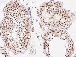 GLI1 Antibody in Immunohistochemistry (Paraffin) (IHC (P))