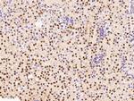 HEXIM1 Antibody in Immunohistochemistry (Paraffin) (IHC (P))