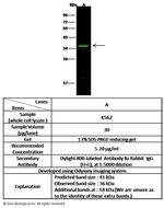 p38 MAPK beta Antibody in Western Blot (WB)