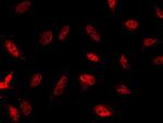 JNK1 Antibody in Immunocytochemistry (ICC/IF)