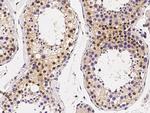 MECP2 Antibody in Immunohistochemistry (Paraffin) (IHC (P))