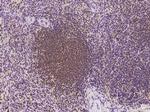 NF2 Antibody in Immunohistochemistry (Paraffin) (IHC (P))