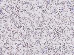 PAX2 Antibody in Immunohistochemistry (Paraffin) (IHC (P))