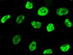 RARB Antibody in Immunocytochemistry (ICC/IF)