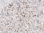 RARB Antibody in Immunohistochemistry (Paraffin) (IHC (P))