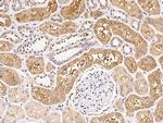 RARB Antibody in Immunohistochemistry (Paraffin) (IHC (P))