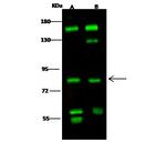 RSK1 Antibody in Western Blot (WB)